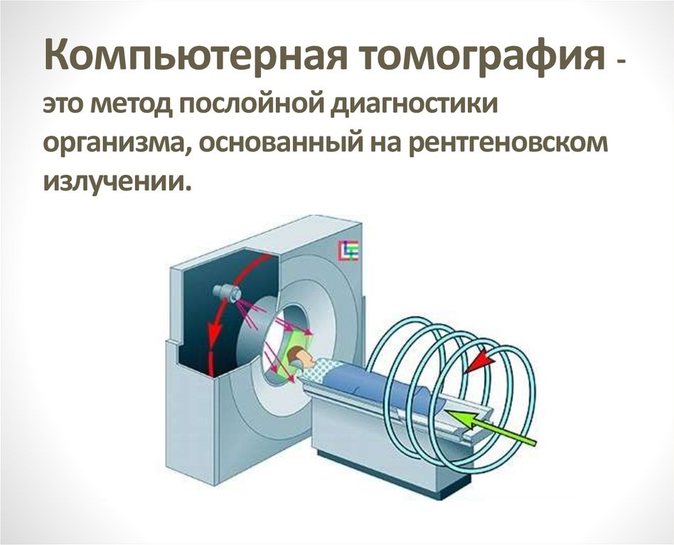 КТ (компьютерная томография)