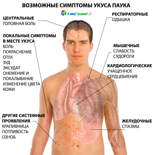Что делать при укусе насекомых?