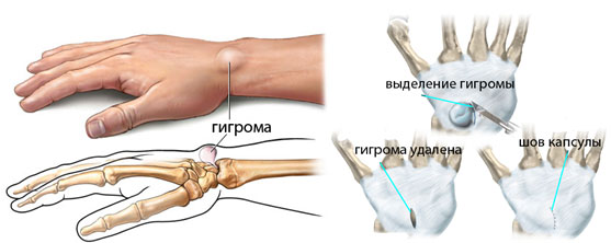 Симптомы